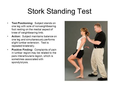 stork test for pars surgery